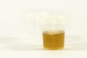 Urine testing